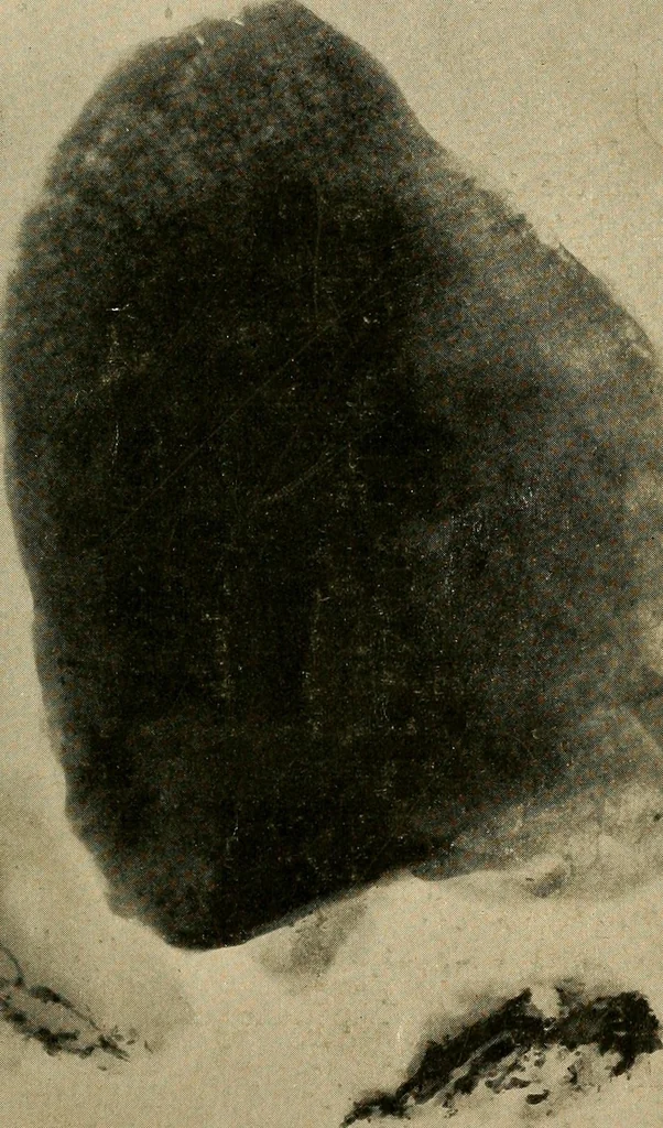 An illustration from The Roentgen rays in medicine and surgery as an aid in diagnosis and as a therapeutic agent : designed for the use of practitioners and students, 1901, leaf 406