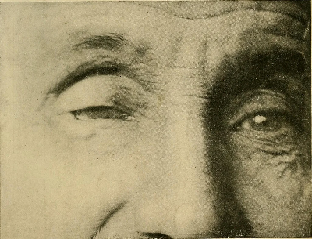 An illustration from The Roentgen rays in medicine and surgery as an aid in diagnosis and as a therapeutic agent : designed for the use of practitioners and students, 1901, leaf 446