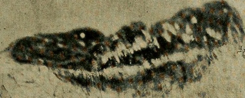 An illustration from The Roentgen rays in medicine and surgery as an aid in diagnosis and as a therapeutic agent : designed for the use of practitioners and students, 1901, leaf 452