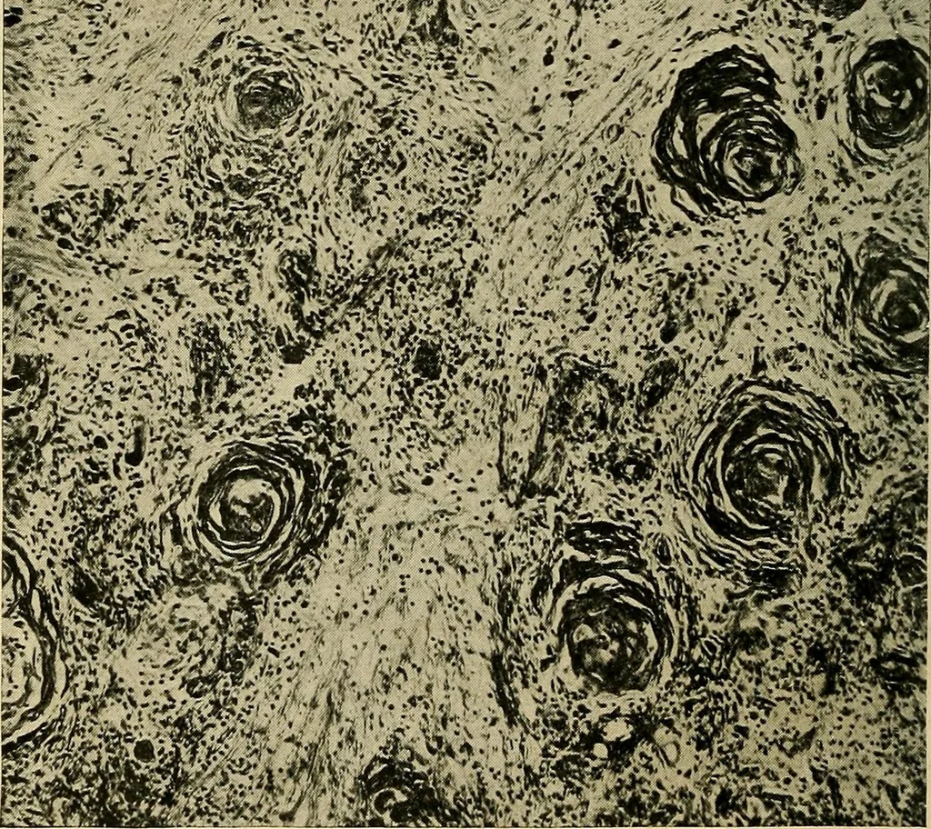 An illustration from The Roentgen rays in medicine and surgery as an aid in diagnosis and as a therapeutic agent : designed for the use of practitioners and students, 1901, leaf 455