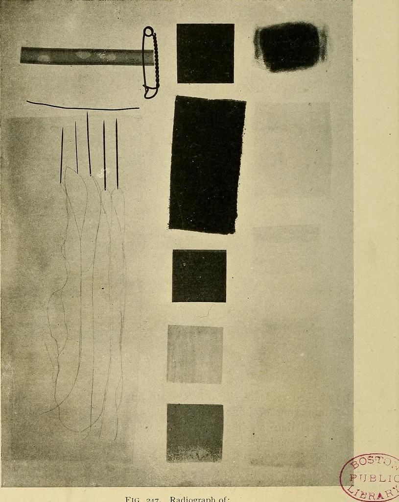 An illustration from The Roentgen rays in medicine and surgery as an aid in diagnosis and as a therapeutic agent : designed for the use of practitioners and students, 1901, leaf 489