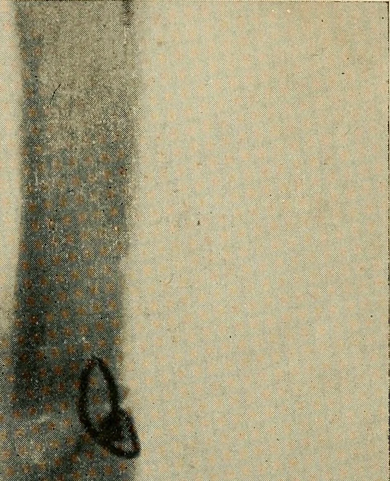 An illustration from The Roentgen rays in medicine and surgery as an aid in diagnosis and as a therapeutic agent : designed for the use of practitioners and students, 1901, leaf 502