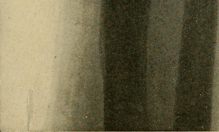 An illustration from The Roentgen rays in medicine and surgery as an aid in diagnosis and as a therapeutic agent : designed for the use of practitioners and students, 1901, leaf 574