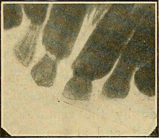 An illustration from The Roentgen rays in medicine and surgery as an aid in diagnosis and as a therapeutic agent : designed for the use of practitioners and students, 1901, leaf 625