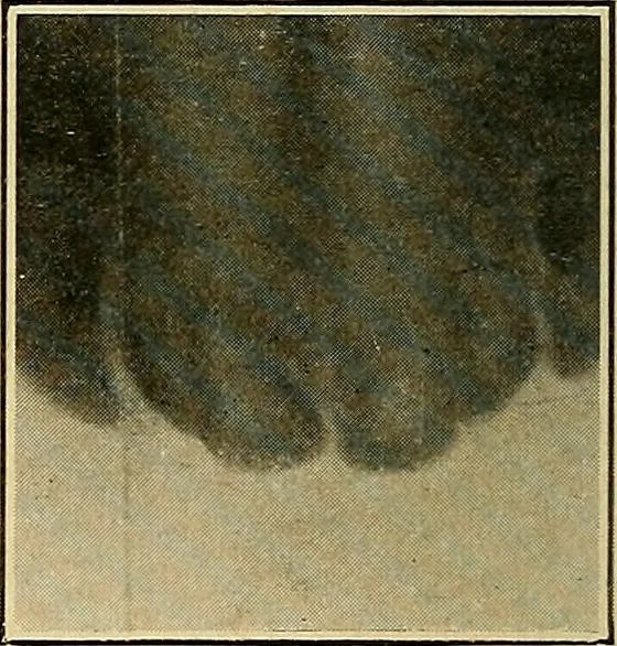 An illustration from The Roentgen rays in medicine and surgery as an aid in diagnosis and as a therapeutic agent : designed for the use of practitioners and students, 1901, leaf 625