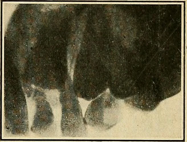 An illustration from The Roentgen rays in medicine and surgery as an aid in diagnosis and as a therapeutic agent : designed for the use of practitioners and students, 1901, leaf 626