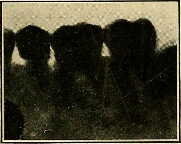 An illustration from The Roentgen rays in medicine and surgery as an aid in diagnosis and as a therapeutic agent : designed for the use of practitioners and students, 1901, leaf 626