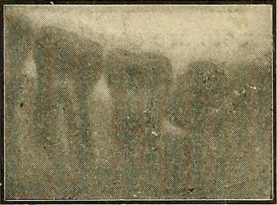 An illustration from The Roentgen rays in medicine and surgery as an aid in diagnosis and as a therapeutic agent : designed for the use of practitioners and students, 1901, leaf 628