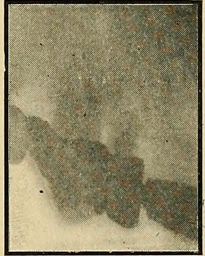An illustration from The Roentgen rays in medicine and surgery as an aid in diagnosis and as a therapeutic agent : designed for the use of practitioners and students, 1901, leaf 628