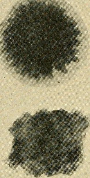 An illustration from The Roentgen rays in medicine and surgery as an aid in diagnosis and as a therapeutic agent : designed for the use of practitioners and students, 1901, leaf 633