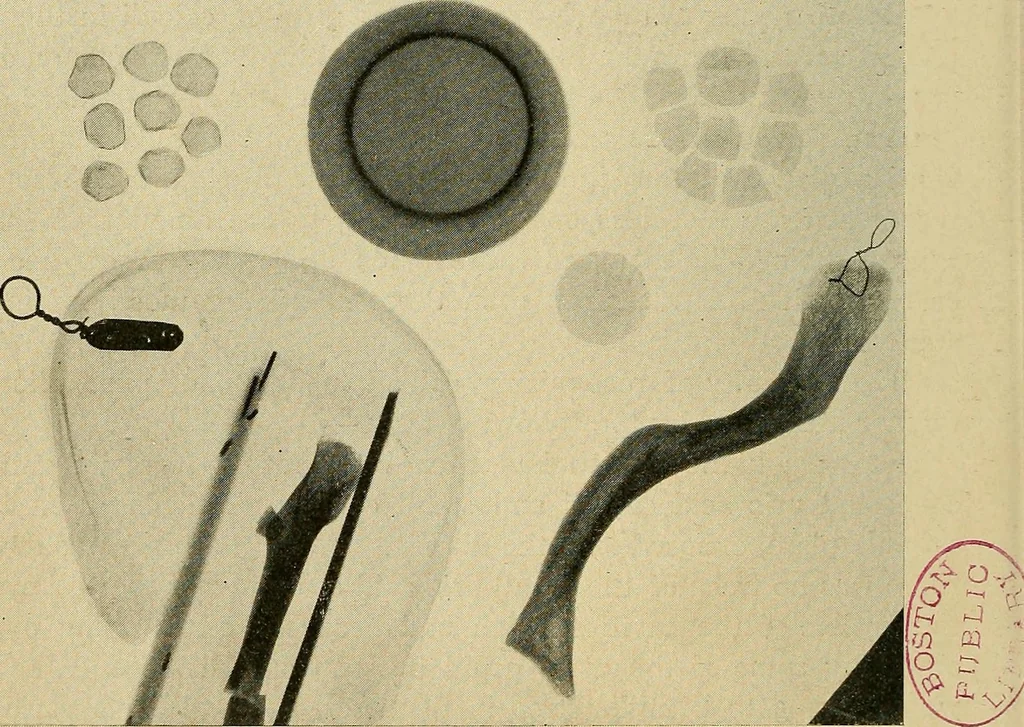 An illustration from The Roentgen rays in medicine and surgery as an aid in diagnosis and as a therapeutic agent : designed for the use of practitioners and students, 1901, leaf 633
