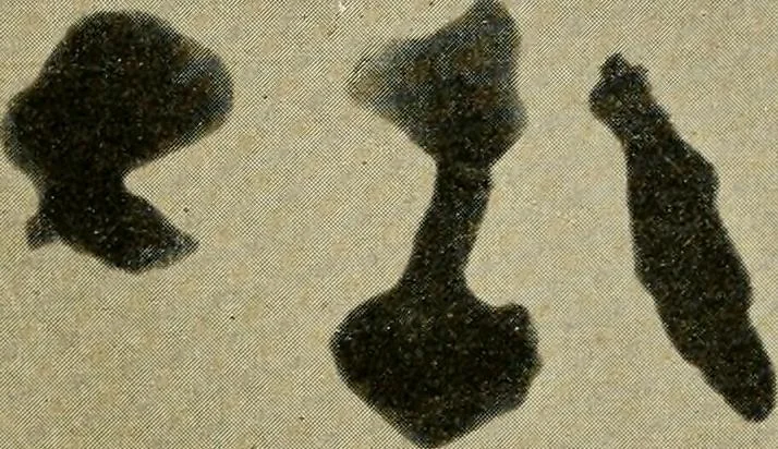 An illustration from The Roentgen rays in medicine and surgery as an aid in diagnosis and as a therapeutic agent : designed for the use of practitioners and students, 1901, leaf 637