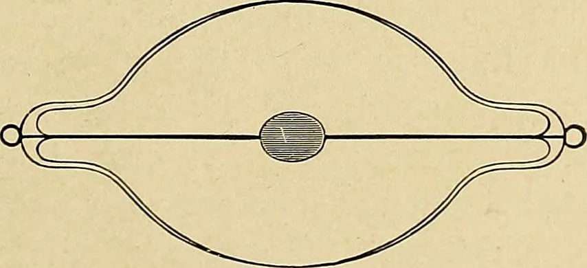 An illustration from The Roentgen rays in medicine and surgery as an aid in diagnosis and as a therapeutic agent : designed for the use of practitioners and students, 1901, leaf 72