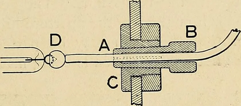An illustration from The Roentgen rays in medicine and surgery as an aid in diagnosis and as a therapeutic agent : designed for the use of practitioners and students, 1901, leaf 84