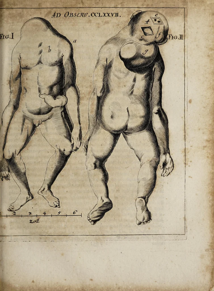 An illustration from Miscellanea curiosa medico-physica Academiæ Naturæ curiosorum, sive, Ephemeridum medico-physicarum Germanicarum curiosarum. 1672., 1672, leaf 571