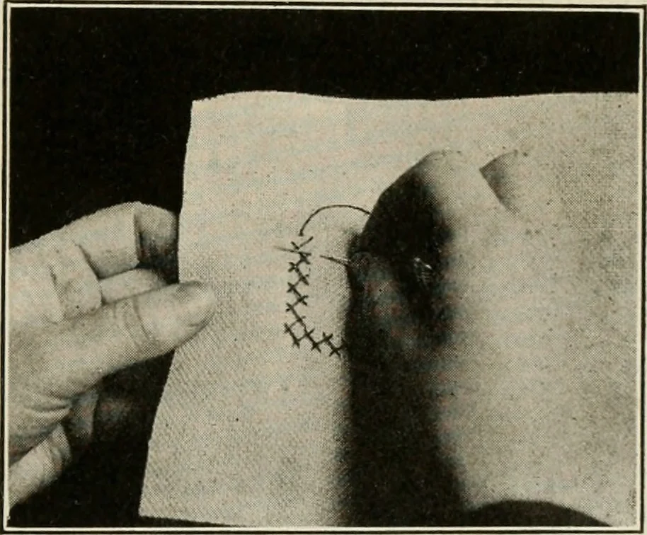 An illustration from School sewing based on home problems, 1916, leaf 320