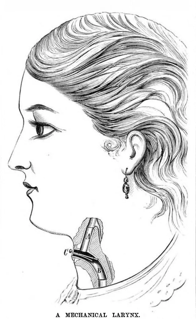 An illustration from Scientific American, Vol. 38, No. 9 (March 1878), 1878, leaf 9