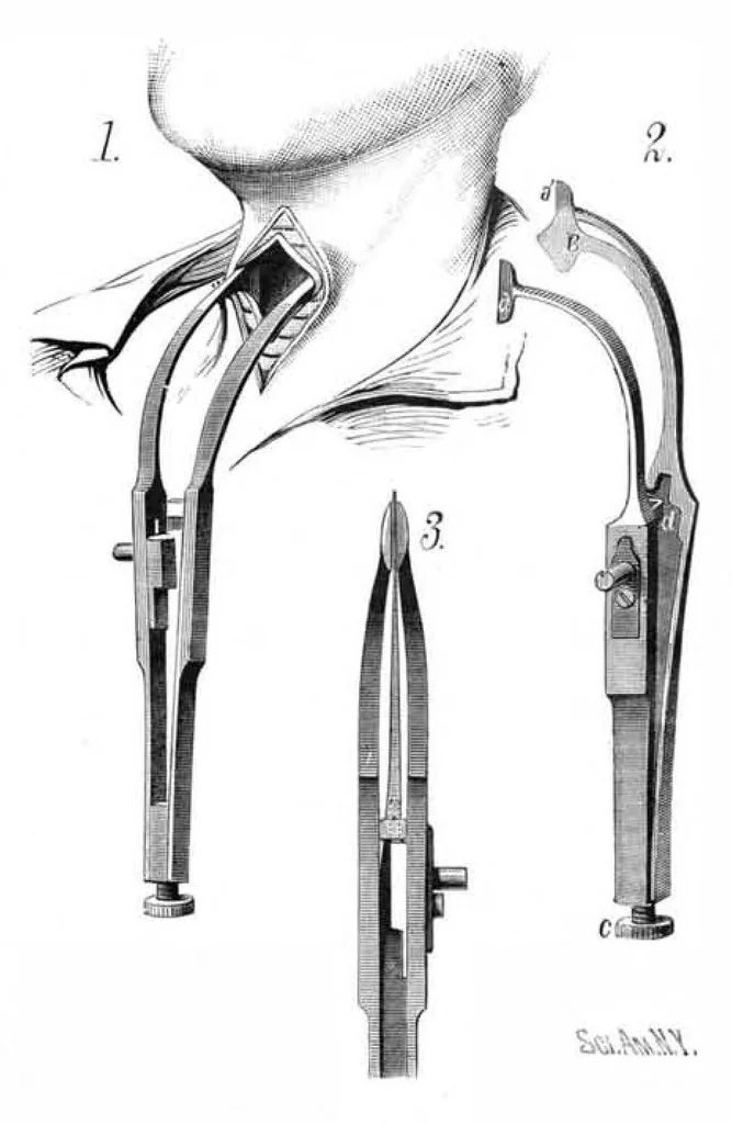 An illustration from Scientific American, Vol. 46, No. 22 (June 1882), 1882, leaf 3