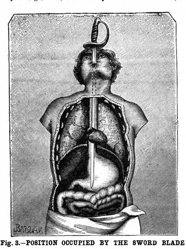 An illustration from Scientific American, Vol. 49, No. 11 (September 1883), 1883, leaf 3