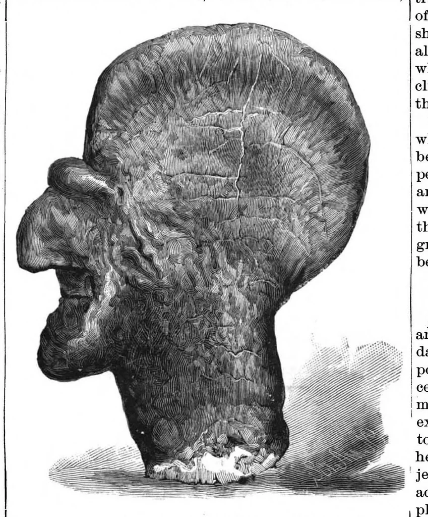 An illustration from Scientific American, Vol. 52, No. 7 (February 1885), 1885, leaf 4