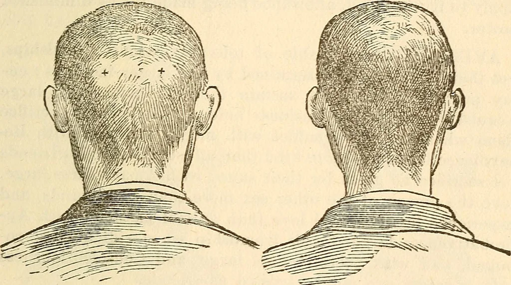 An illustration from The self-instructor in phrenology and physiology; with over one hundred new illustrations, including a chart for the use of practical phrenologists, 1890, leaf 92