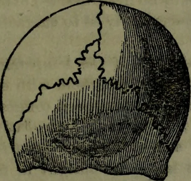 An illustration from The self-instructor in phrenology and physiology : with over one hundred new illustrations, including a chart for the use of practical phrenologists., 1890, leaf 110