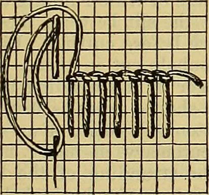 An illustration from A sewing course, comprising directions for making the various stitches and instruction in methods of teaching, 1908, leaf 72