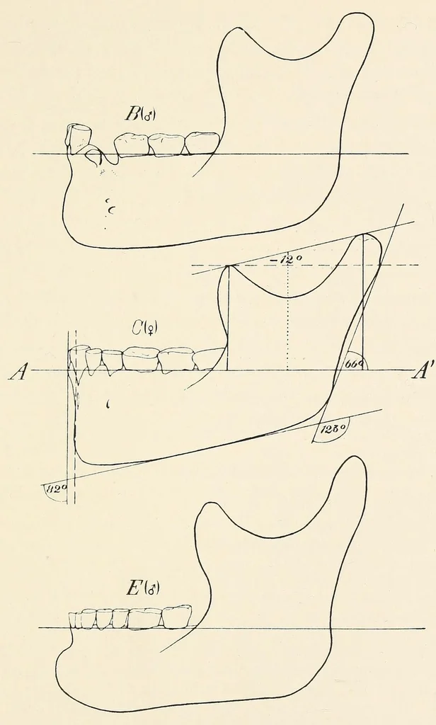 An illustration from Skeletal remains from Santa Barbara, California. : I. Craniology, 1925, leaf 137