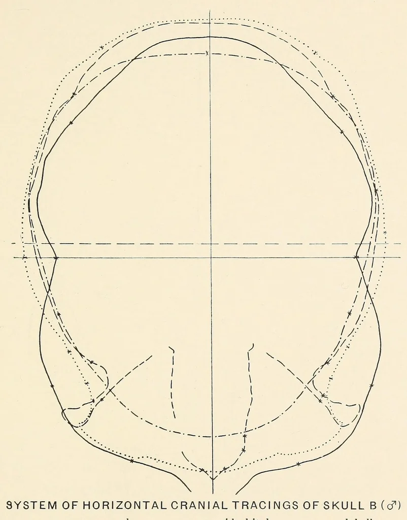An illustration from Skeletal remains from Santa Barbara, California. : I. Craniology, 1925, leaf 179