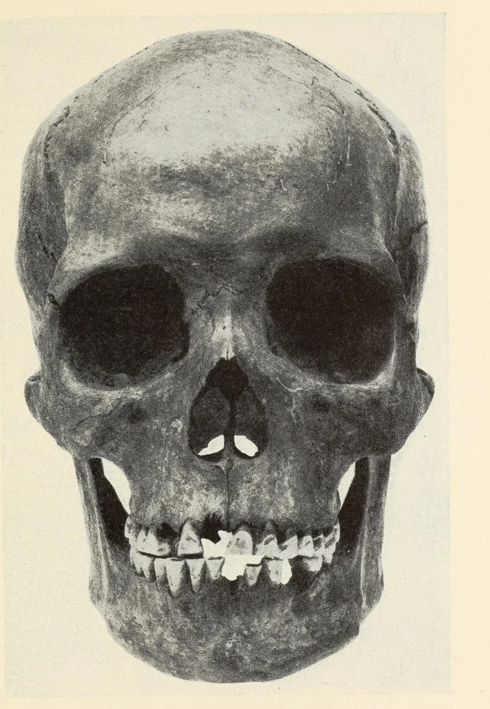 An illustration from Skeletal remains from Santa Barbara, California. : I. Craniology, 1925, leaf 187