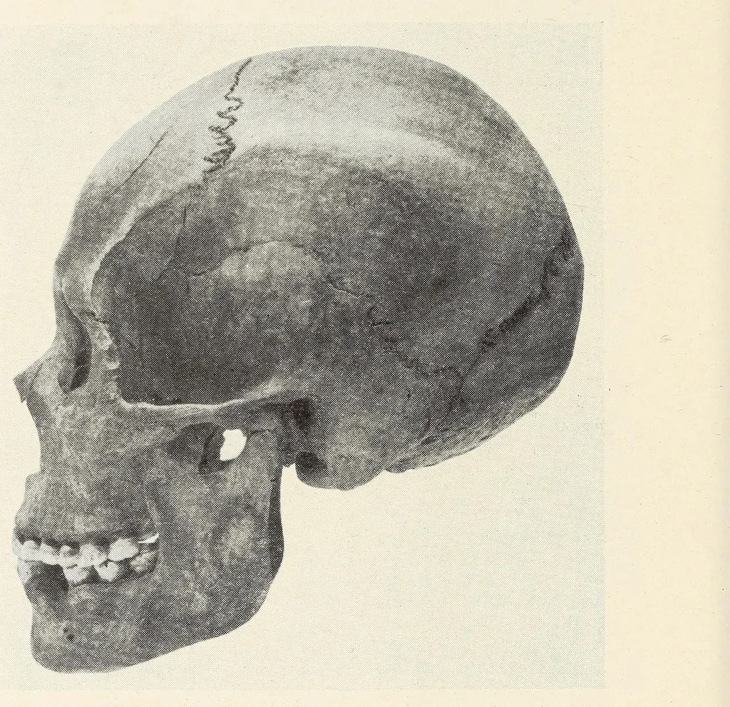 An illustration from Skeletal remains from Santa Barbara, California. : I. Craniology, 1925, leaf 190