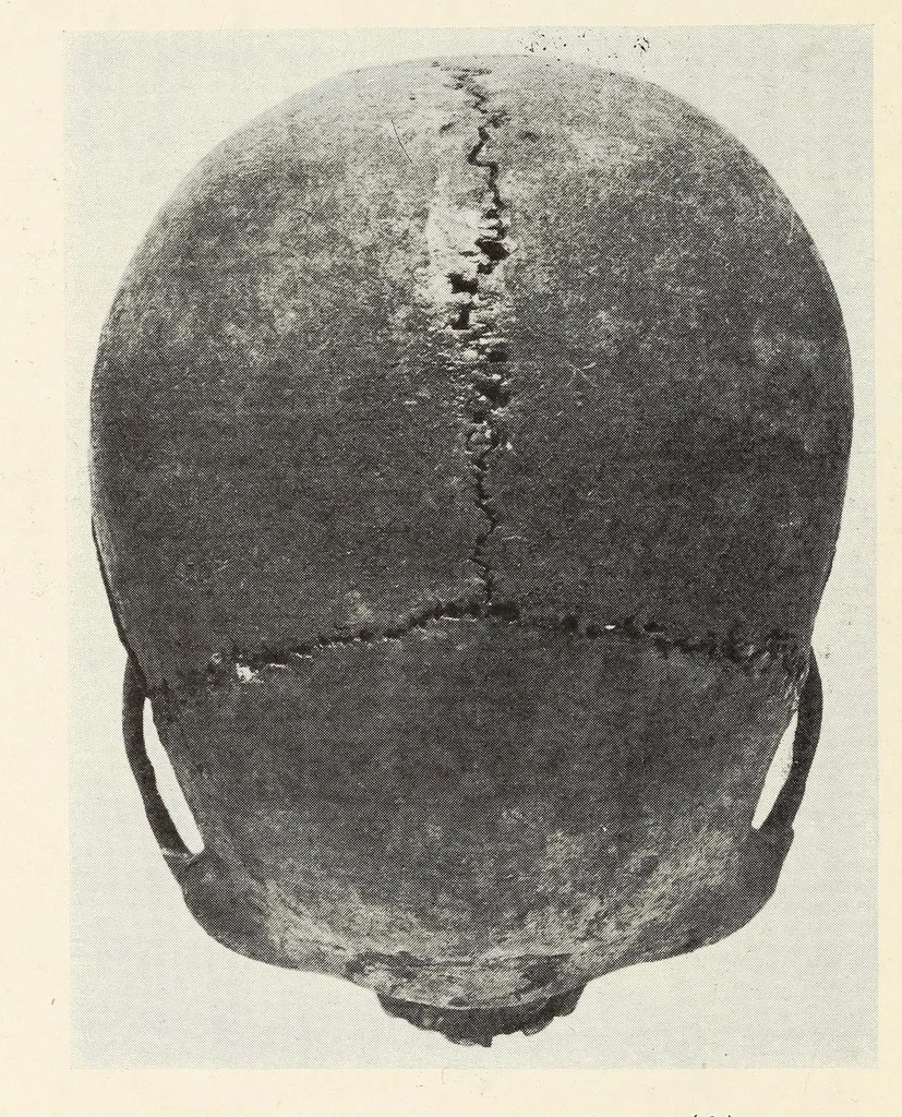 An illustration from Skeletal remains from Santa Barbara, California. : I. Craniology, 1925, leaf 194