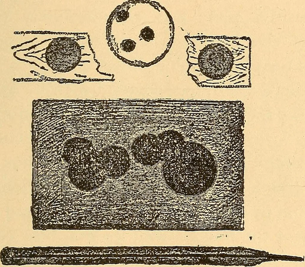 An illustration from Something about X rays for everybody, 1896, leaf 44