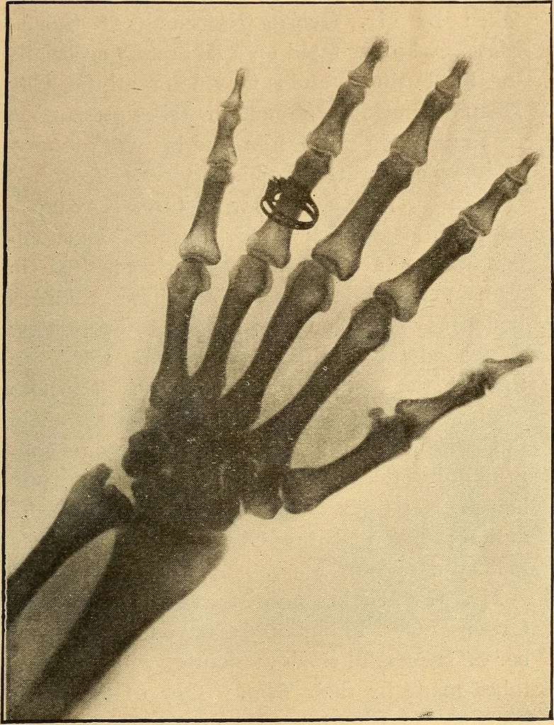An illustration from Something about X rays for everybody, 1896, leaf 54
