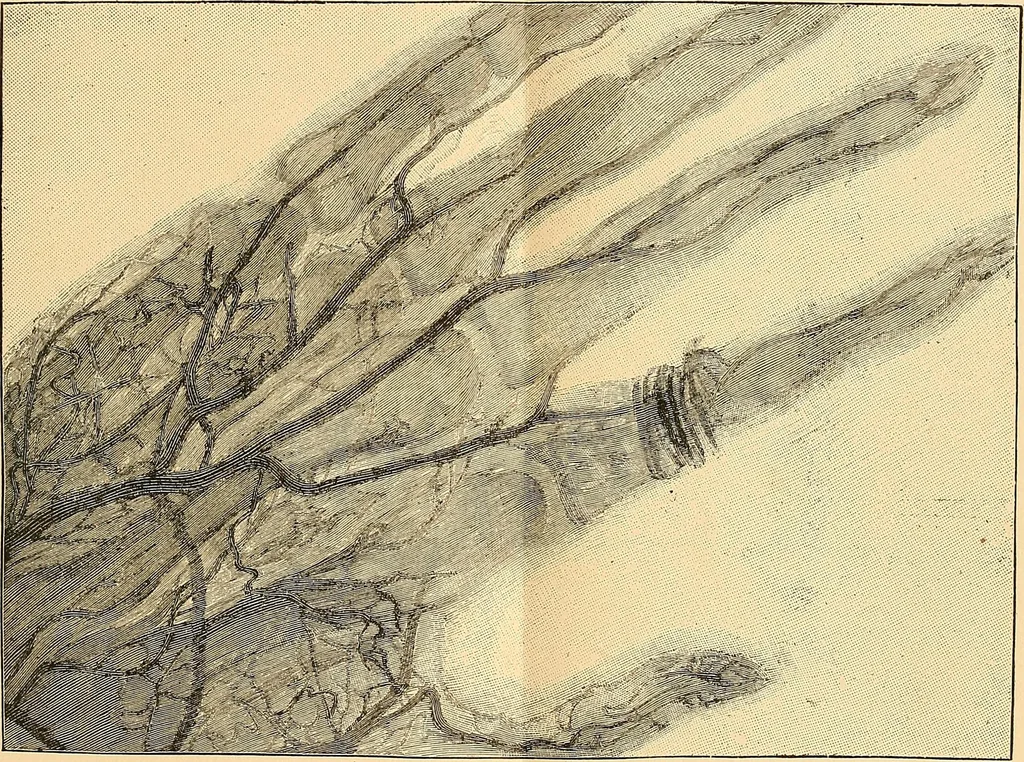 An illustration from Something about X rays for everybody, 1896, leaf 62