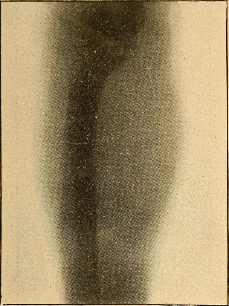 An illustration from Something about X rays for everybody, 1896, leaf 66