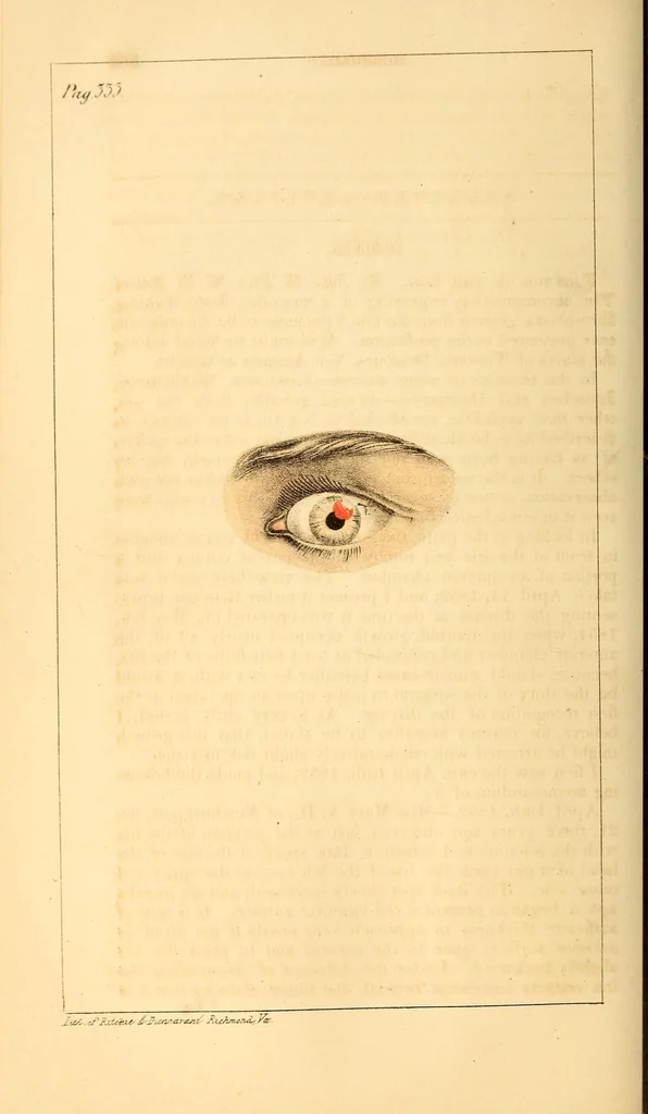 An illustration from The Stethoscope : a monthly journal of medicine and the collateral sciences, 1854, leaf 354