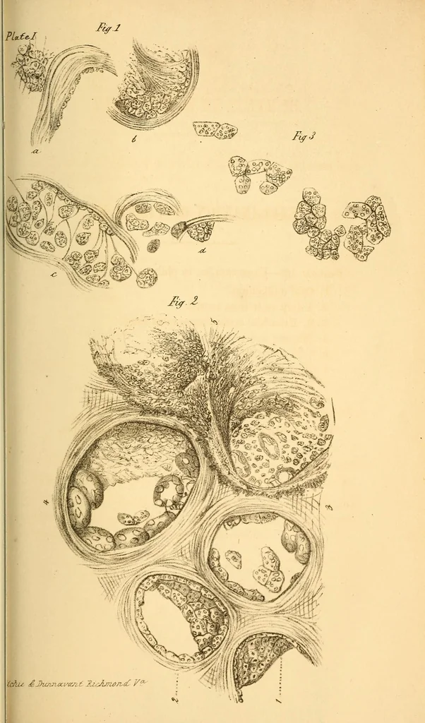 An illustration from The Stethoscope : a monthly journal of medicine and the collateral sciences, 1854, leaf 803