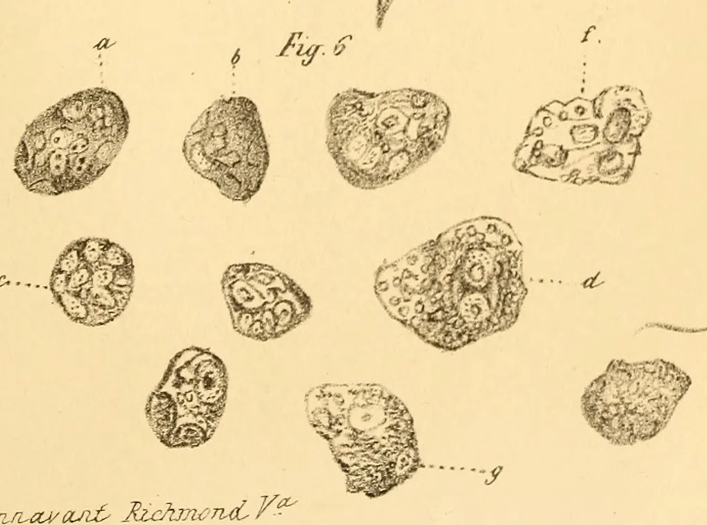 An illustration from The Stethoscope : a monthly journal of medicine and the collateral sciences, 1854, leaf 805