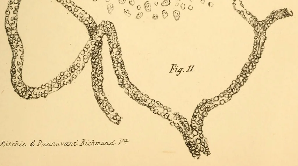 An illustration from The Stethoscope : a monthly journal of medicine and the collateral sciences, 1854, leaf 807