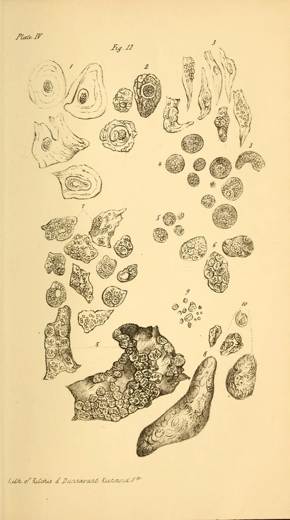 An illustration from The Stethoscope : a monthly journal of medicine and the collateral sciences, 1854, leaf 809
