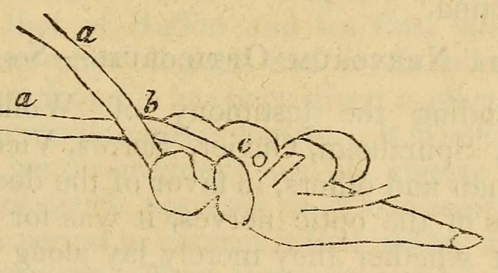 An illustration from The Stethoscope and Virginia medical gazette, 1851, leaf 155