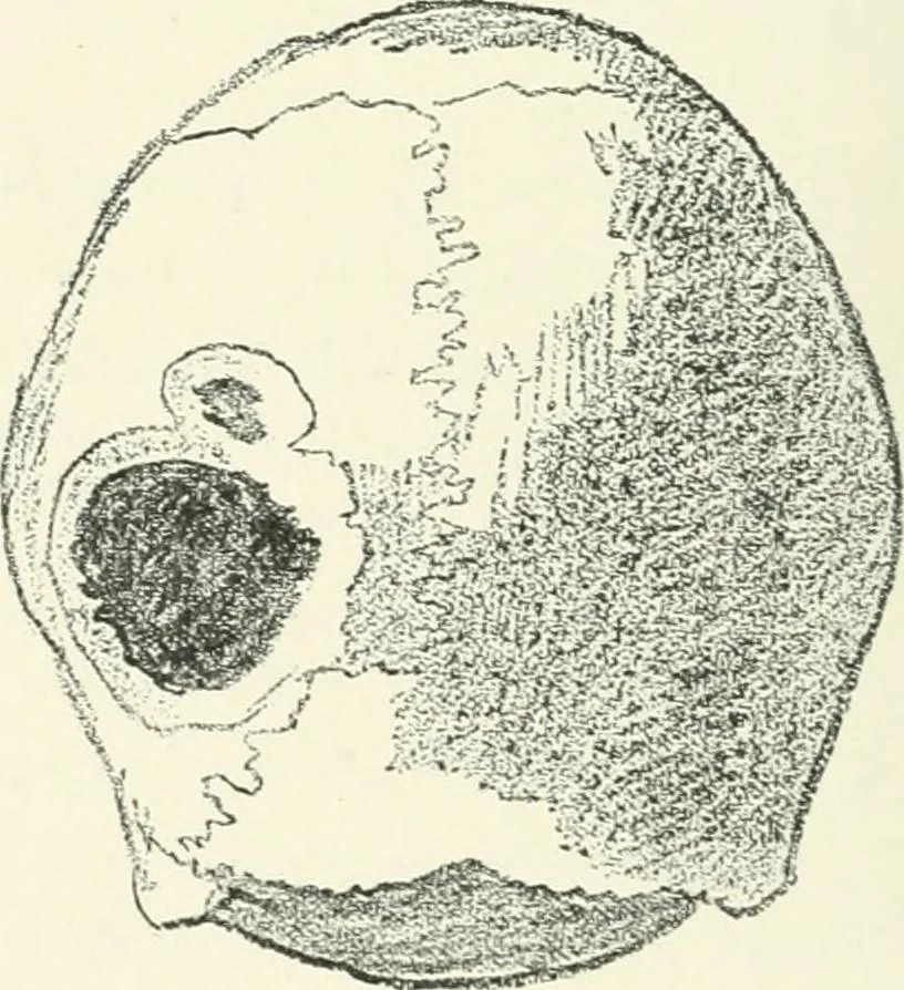 An illustration from Strange survivals : some chapters in the history of man, 1892, leaf 273