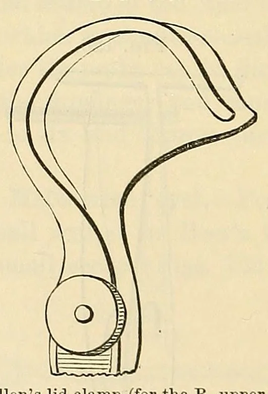 An illustration from The student's guide to diseases of the eye, 1887, leaf 386