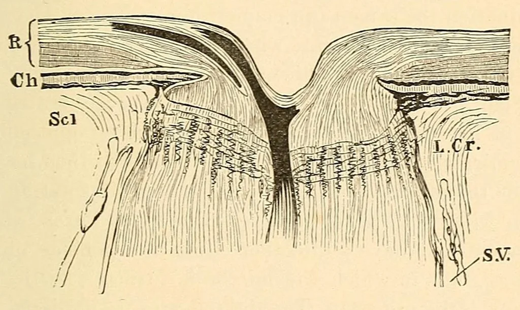 An illustration from The student's guide to diseases of the eye, 1887, leaf 95