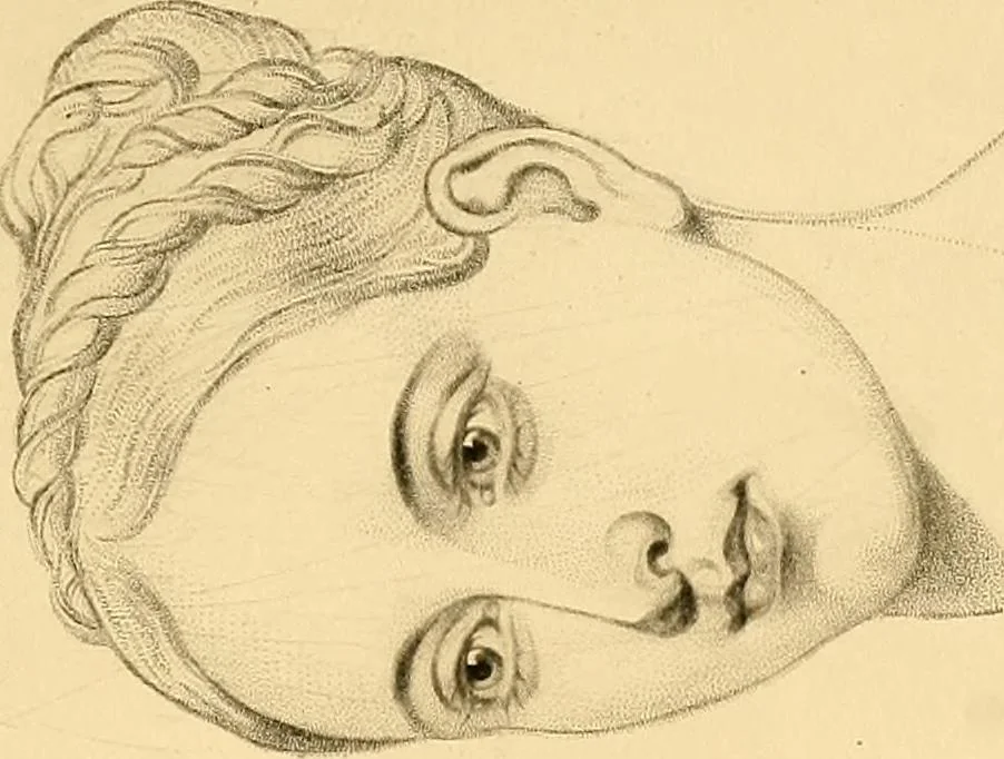 An illustration from The study of the human face, 1865, leaf 238