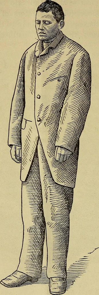 An illustration from The study of trance, muscle-reading and allied phenomena in Europe and America : With a letter of the moral character of trance subjects, and a defence of Dr. Charcot, 1882, leaf 17