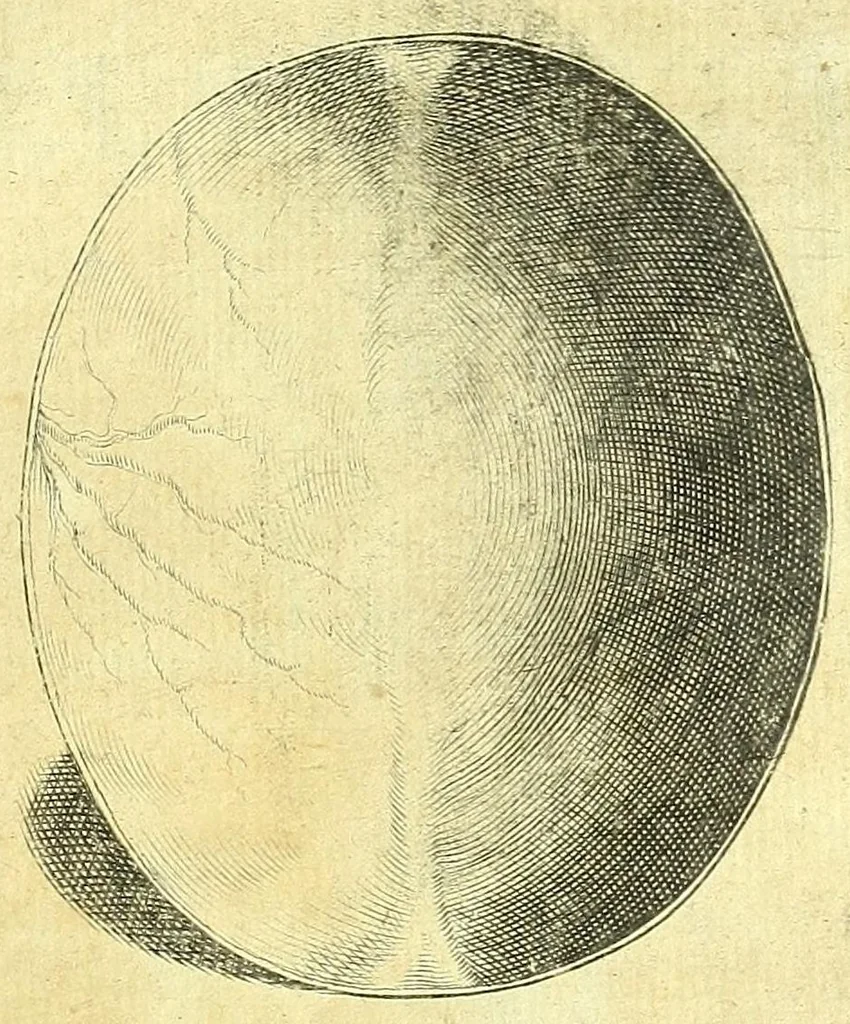 An illustration from Succenturiatus anatomicus : continens commentaria in Hippocratem : De capitis vulneribus :, 1616, leaf 257