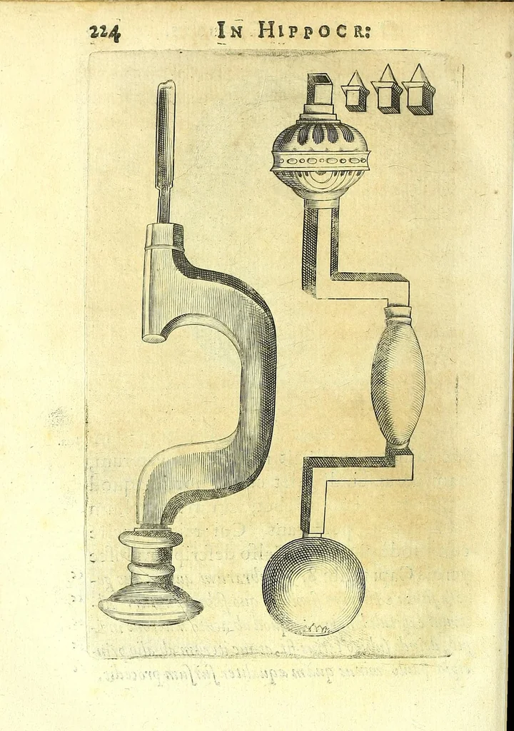 An illustration from Succenturiatus anatomicus : continens commentaria in Hippocratem : De capitis vulneribus :, 1616, leaf 258