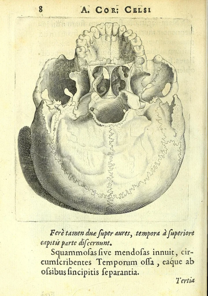An illustration from Succenturiatus anatomicus : continens commentaria in Hippocratem : De capitis vulneribus :, 1616, leaf 314
